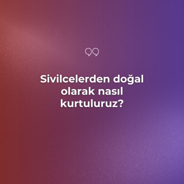 Sivilcelerden doğal olarak nasıl kurtuluruz? 1